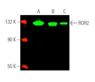 ROR2 Antibody (H-1) - Western Blotting - Image 391028 
