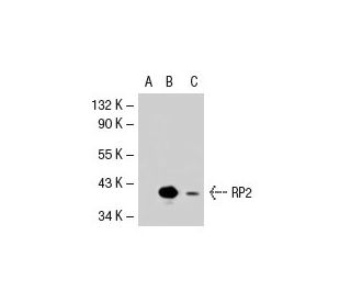 RP2 Antibody (37.28) - Western Blotting - Image 37097