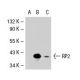 RP2 Antibody (37.28) - Western Blotting - Image 37097