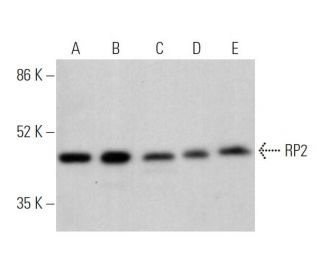 RP2 Antibody (C-9) - Western Blotting - Image 374371 