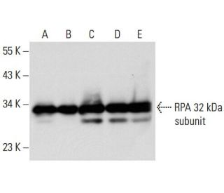 RPA 32 kDa subunit Antibody (9H8) - Western Blotting - Image 19886 