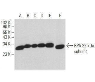 RPA 32 kDa subunit Antibody (MA34) - Western Blotting - Image 361629 