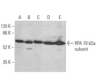 RPA 70 kDa subunit Antibody (B-6) - Western Blotting - Image 362944 