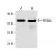 RPE65 Antibody (8B11) - Western Blotting - Image 14612