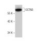 RPMI2650 Whole Cell Lysate: sc-364192. Western blot analysis of SLC22A9...