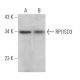 RPUSD3 Antibody (C-2) - Western Blotting - Image 369006 