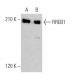 RREB1 Antibody (B-7) - Western Blotting - Image 368607