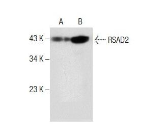 RSAD2 Antibody (G-8) - Western Blotting - Image 287851 
