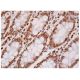 Rsk-1 Antibody (10B1D7) - Immunohistochemistry - Image 284806 