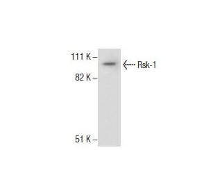Rsk-1 Antibody (T12A6) - Western Blotting - Image 285889 