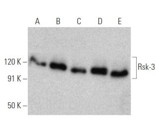 Rsk-3 Antibody (3C4C8) - Western Blotting - Image 372274 