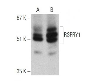 RSPRY1 Antibody (C-8) - Western Blotting - Image 360622 