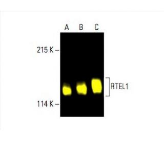 RTEL1 Antibody (H-5) - Western Blotting - Image 392788