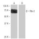 Rtn-2 Antibody (PL-A9) - Western Blotting - Image 65047