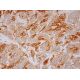 RUNDC3A Antibody (E-2) - Immunohistochemistry - Image 293469 