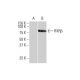 RXRβ Antibody (3C8) - Western Blotting - Image 352141 