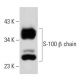 S-100 α/β chain Antibody (6G1) - Western Blotting - Image 19551