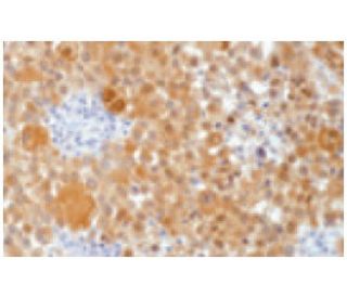 S-100 &alpha; chain Antibody (0.N.555) - Immunohistochemistry - Image 67443
