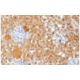 S-100 α chain Antibody (0.N.555) - Immunohistochemistry - Image 67443