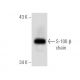 S-100 β chain Antibody (9A11B9) - Western Blotting - Image 137451