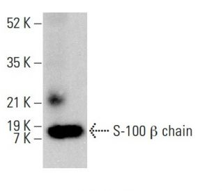 S-100 &beta; chain Antibody (9A11B9) - Western Blotting - Image 378707 