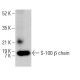 S-100 β chain Antibody (9A11B9) - Western Blotting - Image 378707 