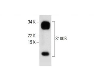 S-100 &beta; chain Antibody (C-3) - Western Blotting - Image 299217 