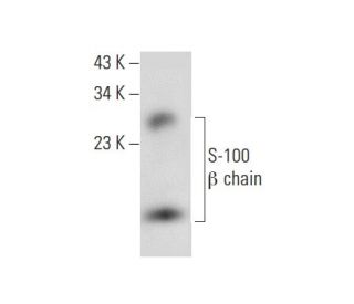 S-100 &beta; chain Antibody (G-9) - Western Blotting - Image 308117