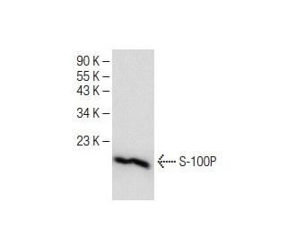 S-100P Antibody (B-10) - Western Blotting - Image 151210