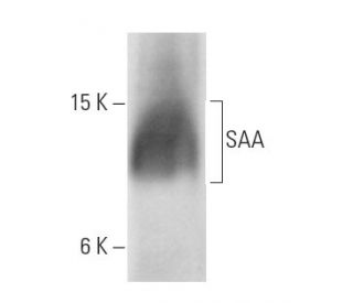 SAA Antibody (SAA1) - Western Blotting - Image 12754