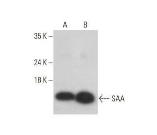 SAA Antibody (SAA15) - Western Blotting - Image 320443 