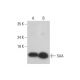 SAA Antibody (SAA15) - Western Blotting - Image 320443 