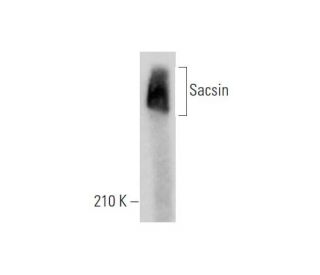 Sacsin Antibody (G-3) - Western Blotting - Image 344143
