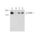 Salubrinal: sc-202332. Western blot analysis of Cofilin 1 phosphorylation in K-562 (A), lambda phosphatase (sc-200312) tre