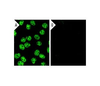Sam 68 siRNA (h): sc-29476. Immunofluorescence staining of methanol-fixed, control HeLa (A) and Sam 68 siRNA silenced HeLa 