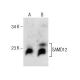 SAMD12 Antibody (A-6) - Western Blotting - Image 281791