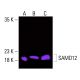 SAMD12 Antibody (A-6) - Western Blotting - Image 416183 