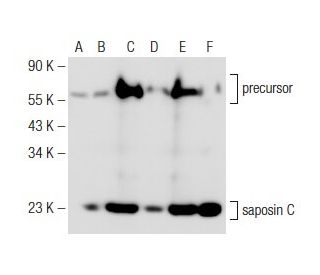 saposin C Antibody (B-10) - Western Blotting - Image 148793 