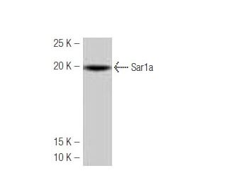 Sar1a Antibody (K-44) - Western Blotting - Image 53963SAM Transcription Activation: SAM system utilizing dCas9-VP64, MS2-P65-HSF1, and sgRNA for precise gene transcription activation.
