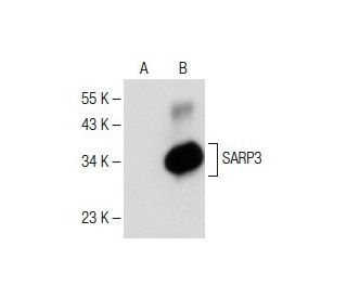 SARP3 Antibody (H-6) - Western Blotting - Image 150293Each CRISPR/Cas9 Knockout (KO) Plasmid product consists of a pool of 3 plasmids designed to ensure identification and cleavage of a specific gene for maximum knockout efficiency. Each plasmid encodes a unique 20 nt sequence derived from the GeCKO (v2) library. 