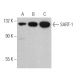 SART-1 Antibody (F-4) - Western Blotting - Image 363817