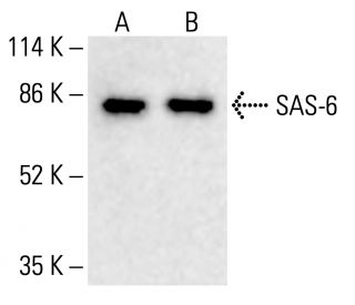 SAS-6 Antibody (91.390.21) - Western Blotting - Image 412710