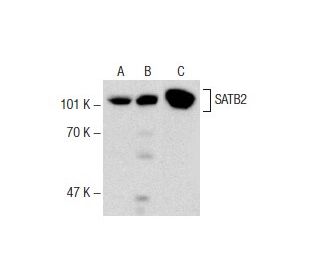 SATB2 Antibody (SATBA4B10) - Western Blotting - Image 141255