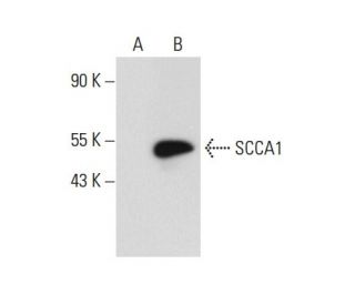 SCCA1/2 Antibody (B-9) - Western Blotting - Image 72247