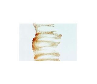 SCCA2 Antibody (10C12) - Immunohistochemistry - Image 3633 