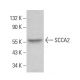 SCCA2 Antibody (39) - Western Blotting - Image 381755