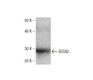 SCCA2 Antibody (64) - Western Blotting - Image 136772