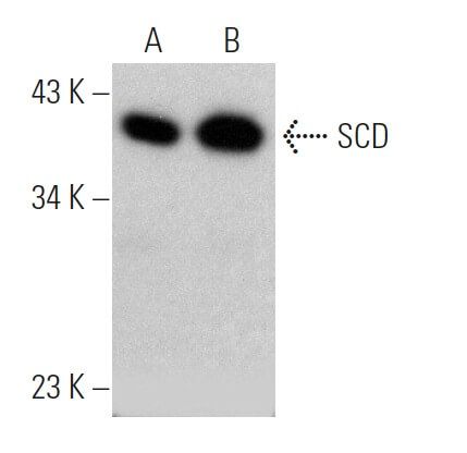SCD CRISPR/Cas9 KO质粒 (h) | SCBIO - Santa Cruz Biotechnology