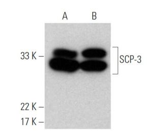 SCP-3 Antibody (D-1) - Western Blotting - Image 370457 