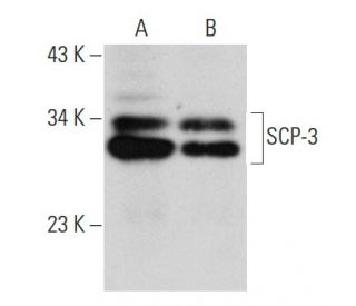 SCP-3 Antibody (G-3) - Western Blotting - Image 30286